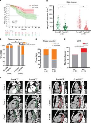 Neoadjuvant immunochemotherapy improves clinical outcomes of patients with esophageal cancer by mediating anti-tumor immunity of CD8+ T (Tc1) and CD16+ NK cells